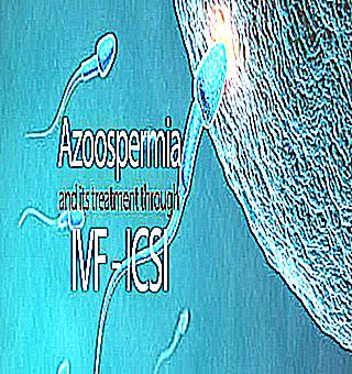 Azoospermia Is The Cause Of Male Infertility