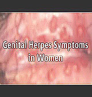 Can Herpes Cause Urethritis