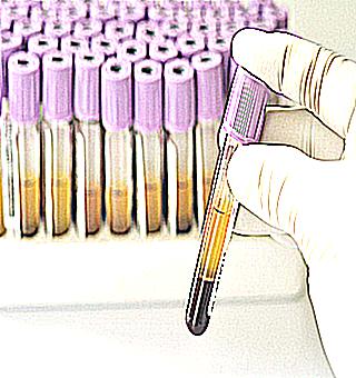 Cancer Detection By Blood Test