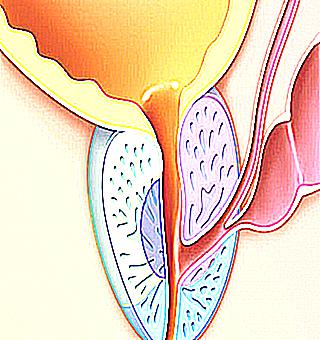 Causes And Treatment Of Young Prostatitis