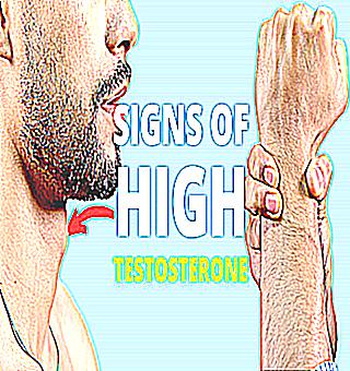 Causes Signs And Effects Of High Testosterone In Men