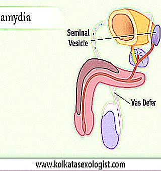 Chlamydial Acute And Chronic Prostatitis Causes And Treatment