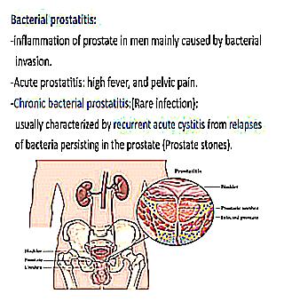 Chronic And Acute Bacterial Prostatitis In Men