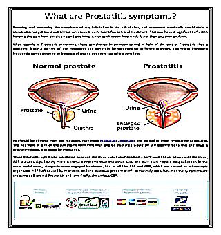 Cuts In Prostatitis