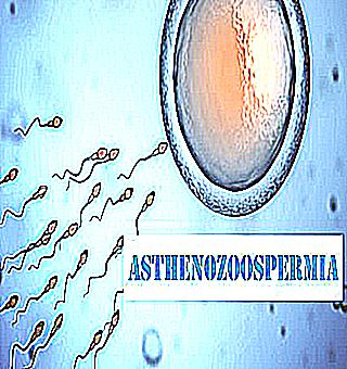 Determination Of Asthenozoospermia
