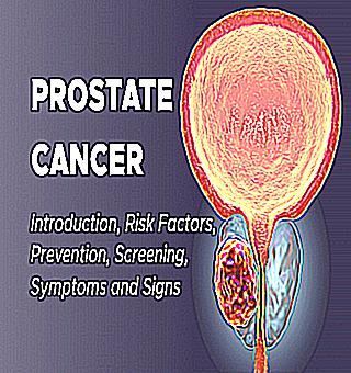 Factors Affecting Prostate Cancer