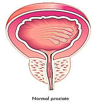 Fever With Inflammation Of The Prostate
