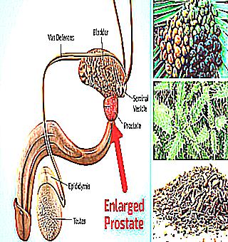 Healthy Prostatitis Creams