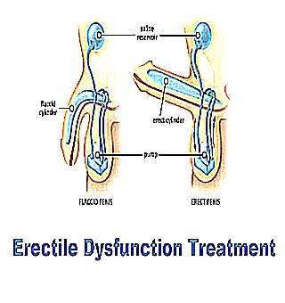 Herbal Treatment For Erectile Dysfunction