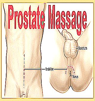 How To Help A Wife Cure Male Prostatitis The Secrets Of Prostate Massage