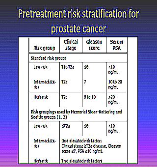 How To Reduce The Risk Of Prostate Cancer