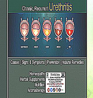 Infectious Urethritis In Women Treatment