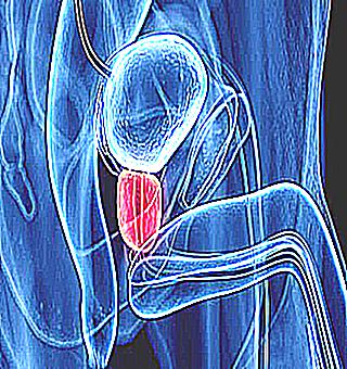 Inflammation Of The Acute Form Of The Prostate