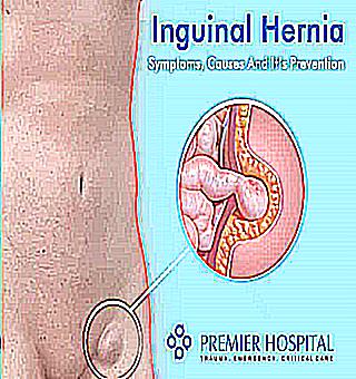Inguinal Hernia In Men Causes Symptoms And Treatment Prevention