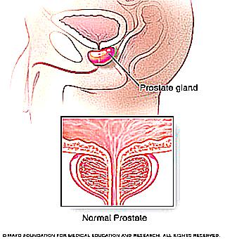 Is There A Sexual Life With Chronic Prostatitis