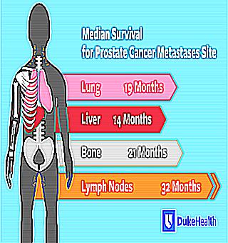 Malignant Prostate Carcinoma Symptoms And Treatments