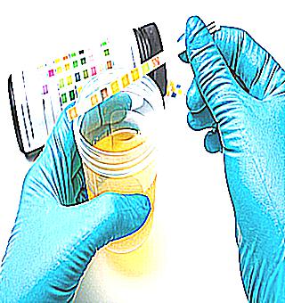 Methods Of Urine Examination In Case Of Suspicion Of A Diagnosis Of Prostatitis