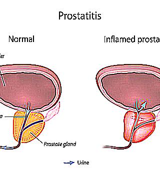 Names Of Drugs For The Treatment Of Prostatitis