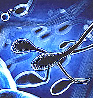 Oligospermia In Spermogram