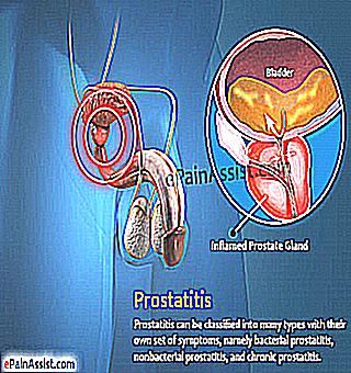 Pain In The Legs In The Treatment Of Prostatitis