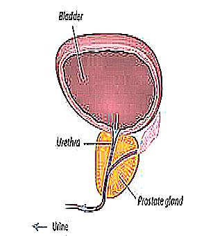 Premature Ejaculation With Prostatitis