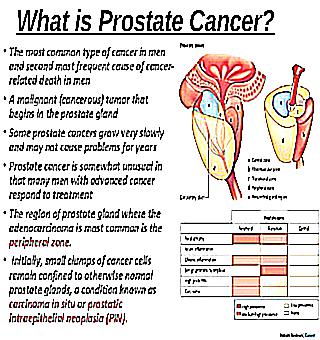 Prostate Cancer Symptoms In Men