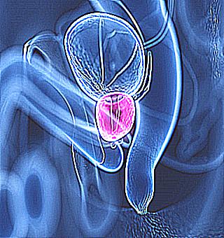 Prostate Diseases In Men