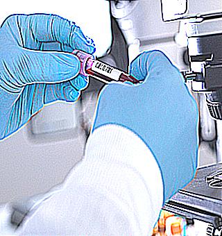 Prostate Specific Antigen Test