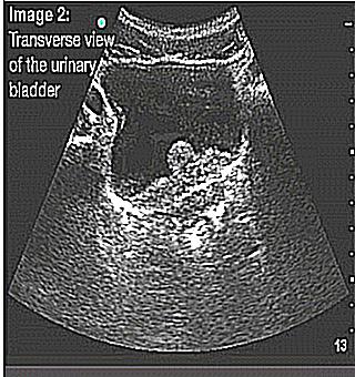 Recommendations For Preparing For An Ultrasound Of The Bladder
