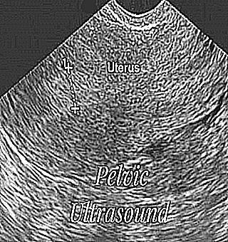 Rules For Preparing Patients For Ultrasound Of Organs In The Small Pelvis