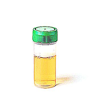 Soreness After Outflow Of Urine In Men