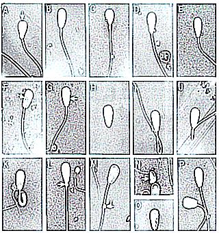 Sperm Morphology