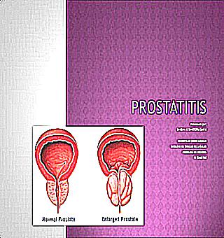 The Latest Dosage Forms For Prostatitis
