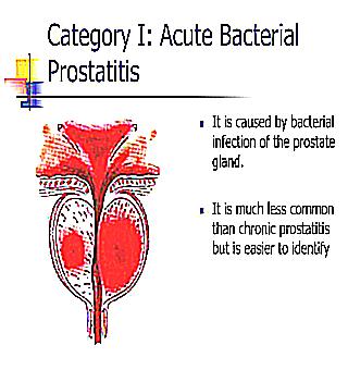 Treatment Of Prostatitis With Prostatitlen
