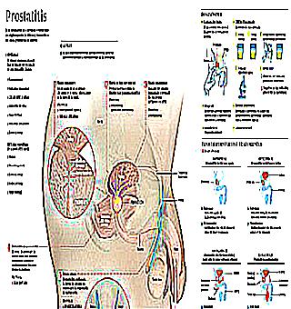 Treatment Of Prostatitis With Sex