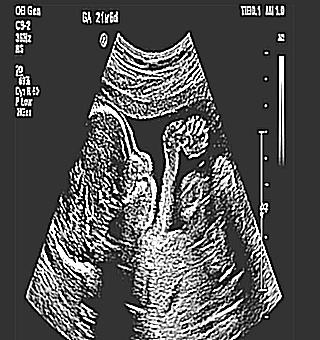 Ultrasound Of The Prostate Gland In Zelenograd