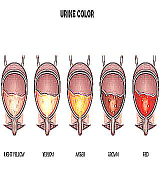 Urine Is Reddish In Men