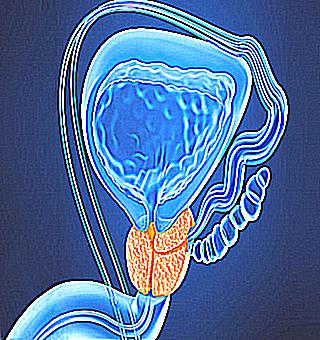 What Does Prostate Disease Affect