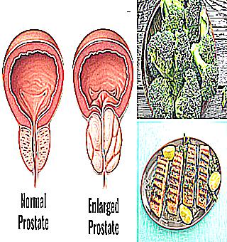 Why Are Changes Occurring In The Prostate