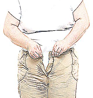 Impotence With Overweight