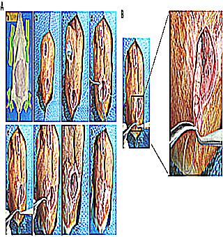 Why Does Sperm Flow Out Instead Of Shooting