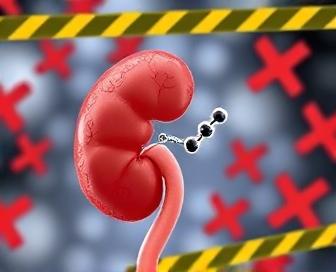 Lasix (Furosemide) and Acute Kidney Injury Risk Factors