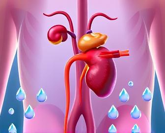 Lasix MOA diagram showing increased urine production