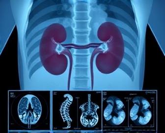 Nuclear Medicine Renal Scan with Furosemide (Lasix) - Procedure