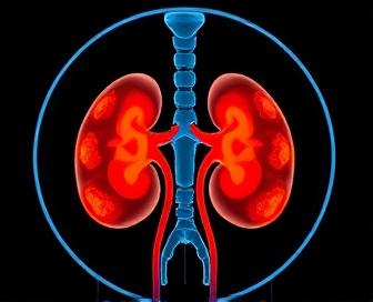 Nuclear Renal Scan with Lasix Procedure