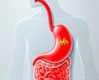 Prednisone and Acid Reflux: Understanding the Link